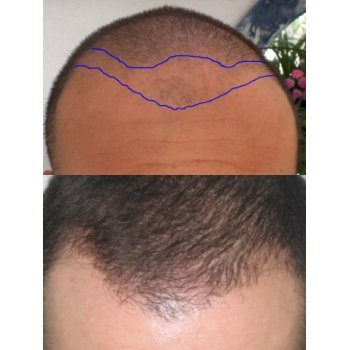 Design Hairline