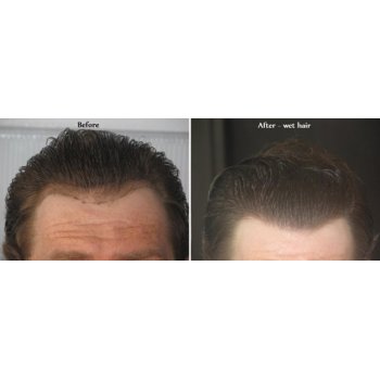 Before and After 3